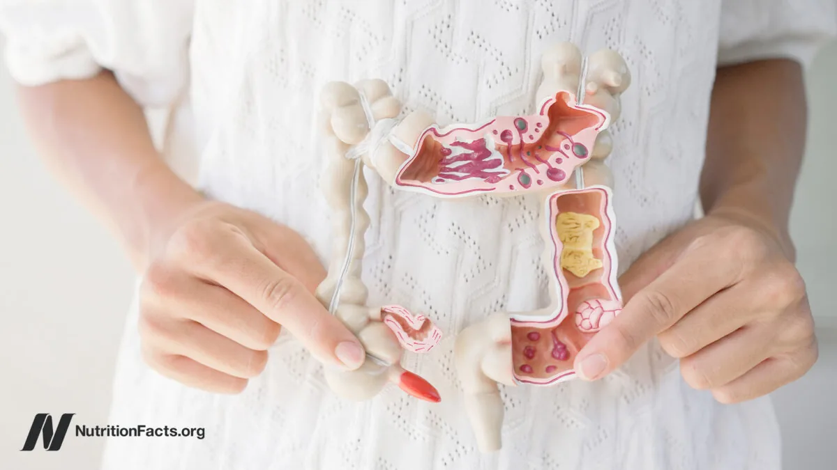 Best Foods to Heal Leaky Gut Naturally